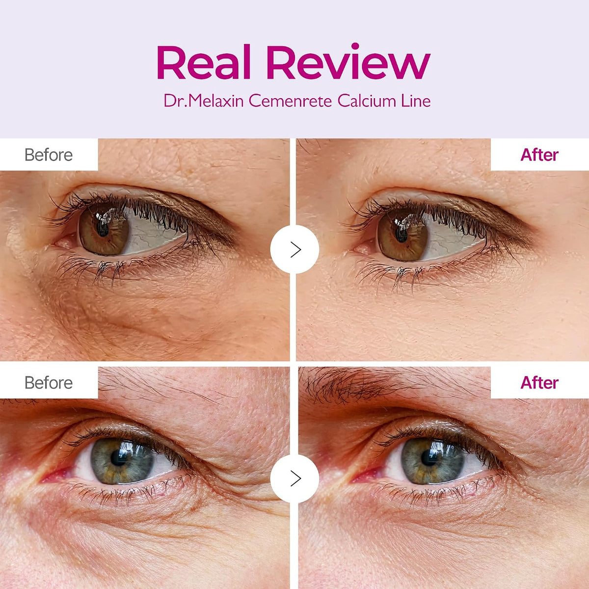 Calcium Volume under Eye Patches for Puffy Eyes & Dark Circles, Hydrogel Eye Mask for Wrinkles, Fine Lines & Sagging Skin, Firming Collagen Eye Patch, Korean Skin Care (60 Count)