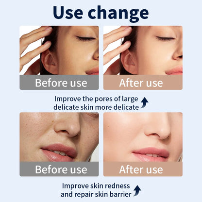 RadiancePro LED Face Mask