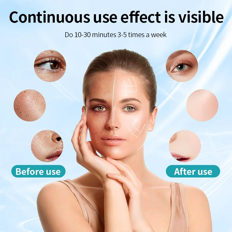 RadiancePro LED Face Mask