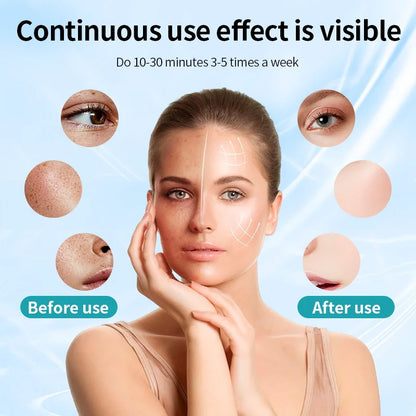 RadiancePro LED Face Mask